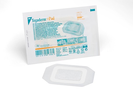 Avoid Tegaderm Reactions Your Ultimate Guide To Alternatives - sekskw3