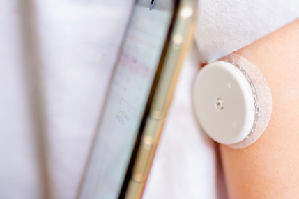 Doubek_CGM-scalia-gallery-fullwidth Continuous glucose monitor